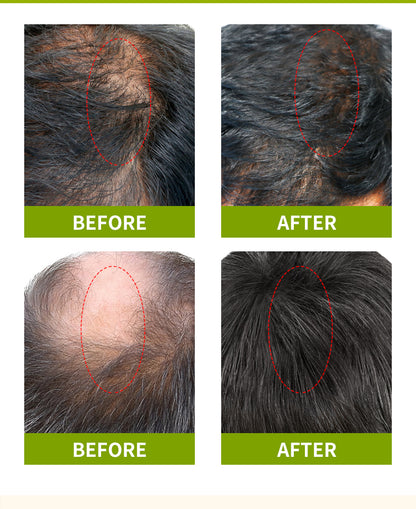 Rosemary Peppermint Hair Growth Serum